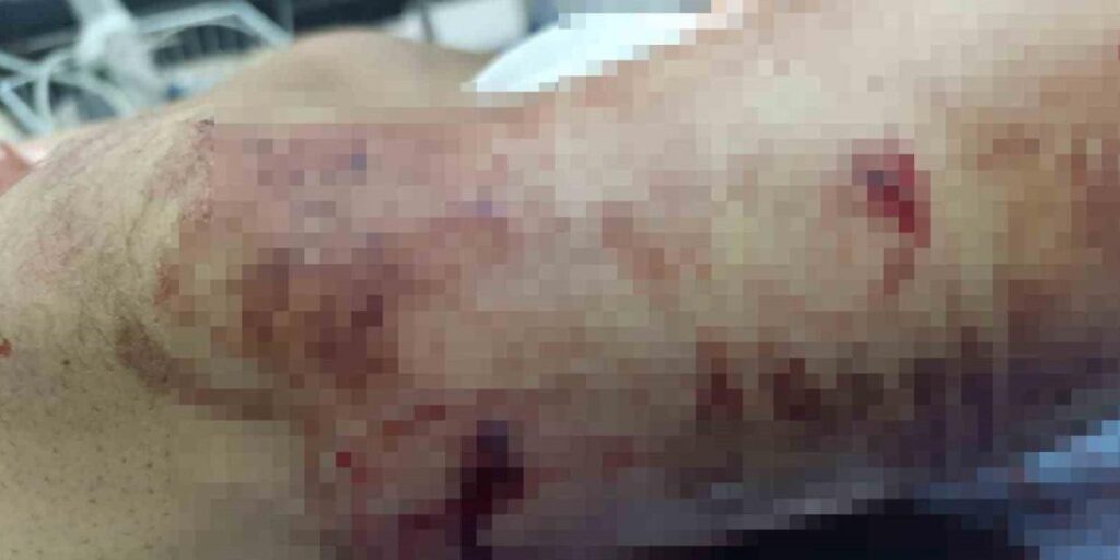 Muş’ta ayının saldırdığı çocuk yaralandı