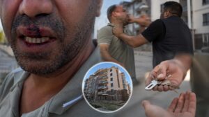 Anahtar Teslimi Sonrası ‘Para İstendi’ İddiası Hastanede Bitti
